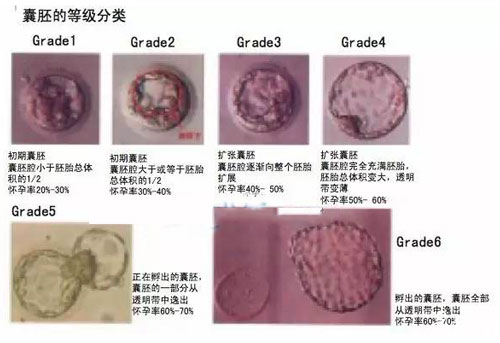 胚胎的等级划分